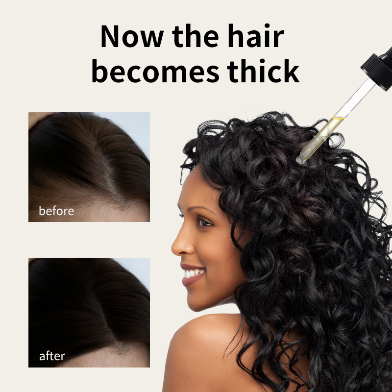 Huile de croissance des cheveux Syulli | Huile anti-chute de romarin et de gingembre | Stimuler les follicules