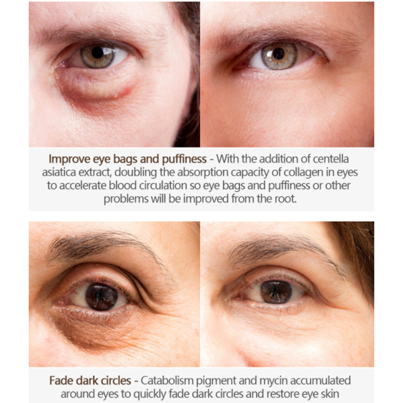 Cr&egrave;me yeux anti-rides personnalis&eacute;e avec applicateur (2) 